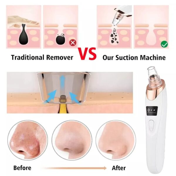 Pore Vacuum Cleaner - Image 2