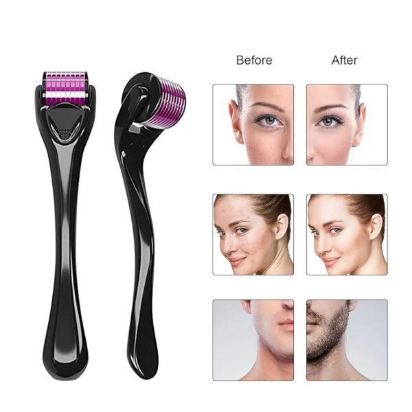 540 Titanium Derma Roller - Image 2