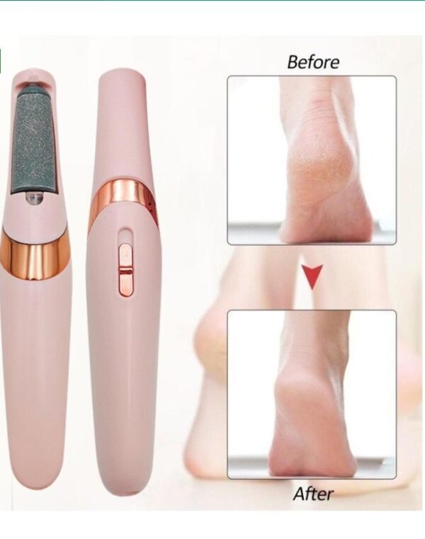 Electric Foot Sharpener | File Grinder | Dead Skin Remover - Image 3